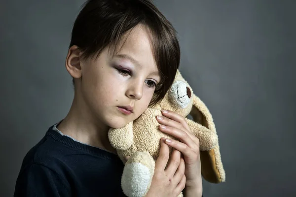 Menino Escola Triste Com Olho Negro Hematomas Abuso Infantil Lesão — Fotografia de Stock