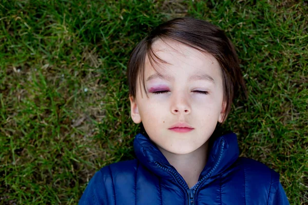 Gözü Morarmış Morarmış Çocuk Istismarı Yaralanmış Küçük Bir Okul Çocuğu — Stok fotoğraf