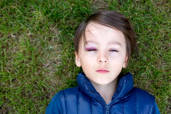 Trauriger Kleiner Schuljunge Mit Blauem Auge Prellungen Kindesmissbrauch Und Verletzungen — Stockfoto