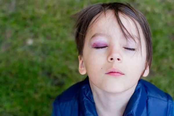 Menino Escola Triste Com Olho Negro Hematomas Abuso Infantil Lesão — Fotografia de Stock