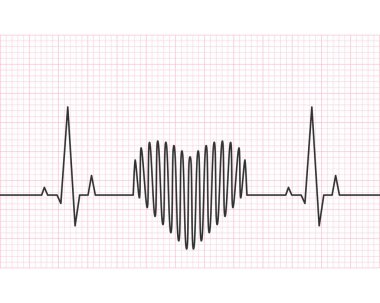 Arka planda ızgara olan kalp atış çizgisi. Kalp atışı, nabız ve ritim, elektrokardiyogram ve EKG konsepti. Vektör illüstrasyonu.