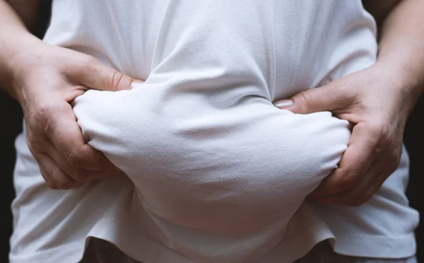 Primer plano del vientre de la mujer gorda . — Foto de Stock