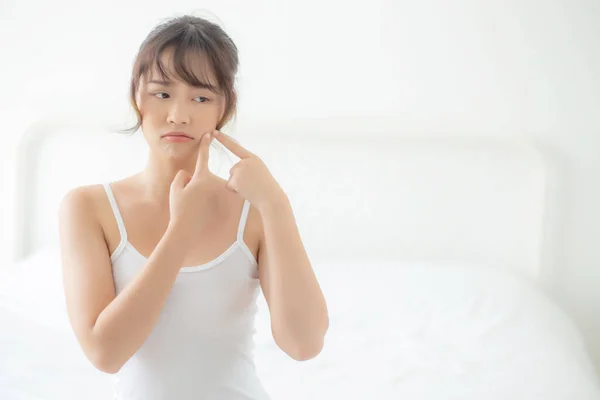 Smukke Portræt Ung Asiatisk Kvinde Med Acne Problem Soveværelset Problemer - Stock-foto