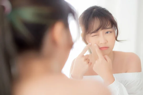 Retrato Bonito Jovem Asiático Mulher Olhando Espelho Uma Acne Tratamento — Fotografia de Stock