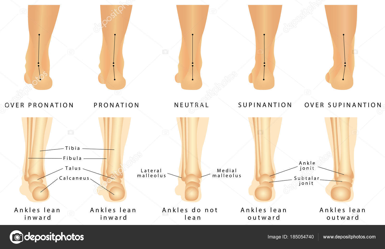 Foot Deformation Valgus Varus Defect Normal Human Foot Foot Pronation foot-deformation-valgus-varus-defect-normal-human-foot-foot-pronation