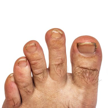 Beyaz arka planda uzun ve kirli tırnakları olan bir erkek ayak. İzole et