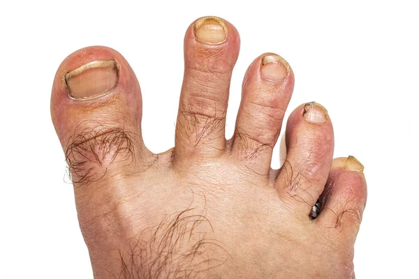 Beyaz arka planda uzun ve kirli tırnakları olan bir erkek ayak. İzole et