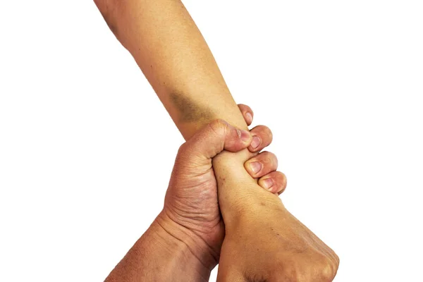 Adam vahşice kızın elini tuttu ve morluklar ortaya çıktı..