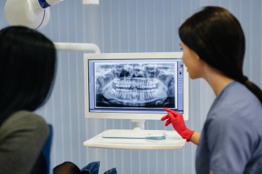 Diş hekimi hastanın dişlerinin bir resmini gösterir ve gerekli tedaviyi söyler. Diş sağlığı, sağlık.