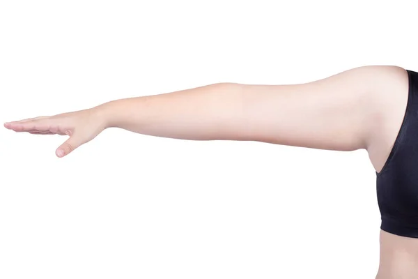 Mujer gorda cirugía marca brazo corte cuerpo grasa cirugía plástica liposucción concepto —  Fotos de Stock