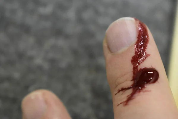 Yaralı parmaktan kırmızı kan damlıyor..
