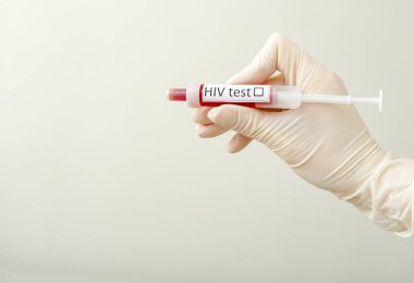 HIV AIDS tıbbi testi. Doktorlarda yapılan HIV testi beyaz bir arkaplanda eldiven ve metin için yer bırakmıştır. Kan şırıngası, araştırma, analiz, tıp. HIV enfeksiyonu üzerinde HIV testi etiketli kan örneği.