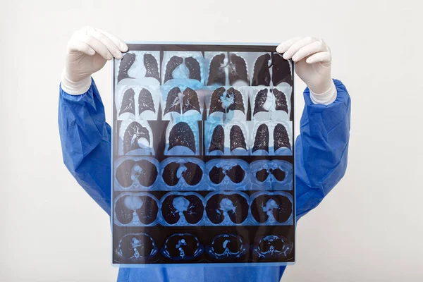 Koruyucu üniformalı doktor MRI akciğer taramasının röntgenini kontrol et. Coronavirus Covid 19, zatürree, tüberküloz, akciğer kanseri, solunum hastalıkları. Tıp ve sağlık hizmetleri kavramı.