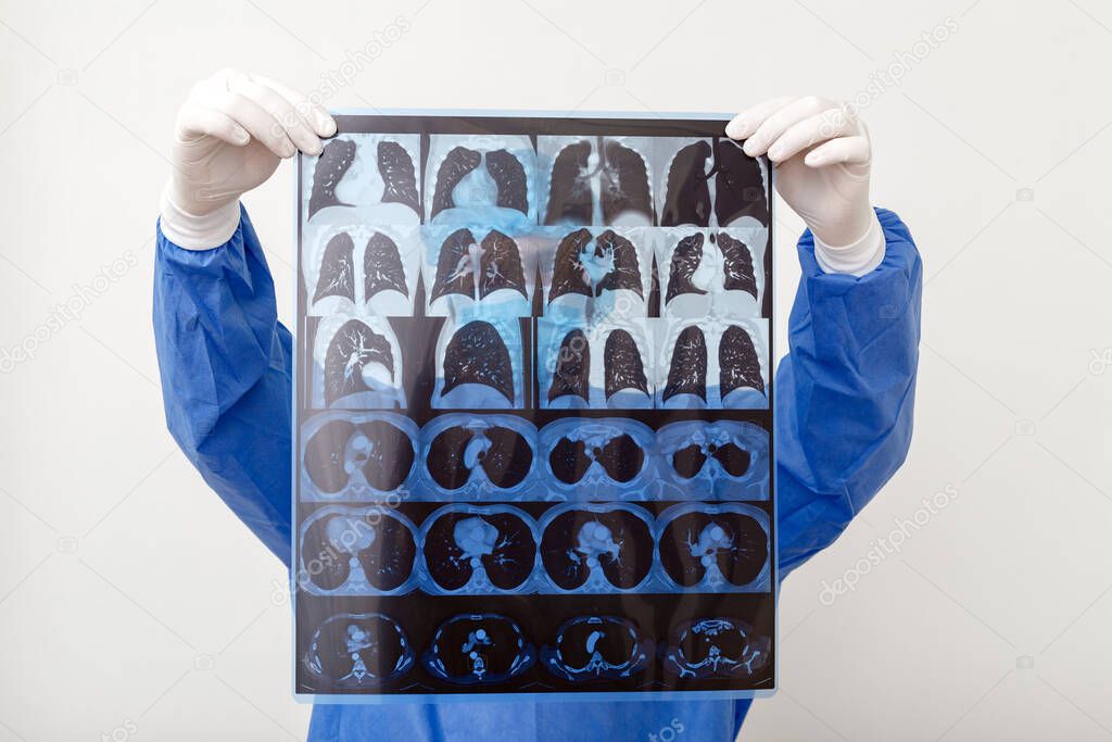 Doctor surgeon in protective uniform check up x ray film of MRI lungs scan. Coronavirus Covid 19, pneumonia, tuberculosis, lung cancer, respiratory diseases. Concept of medicine and health care.