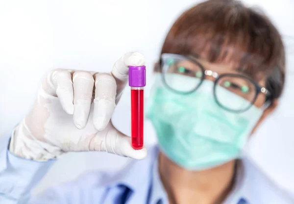 Zamknij Probówkę Zakażoną Próbką Krwi Diagnostyki Koronawirusu Covid Ręku Lekarza — Zdjęcie stockowe