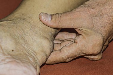 Eklem ağrısı, kemik ağrısı, gut, romatizma semptomları, radyoaktif hastalık, erkek osteoporozu, yaralı kemik, yaralanma, ağrı, eklem iltihabı, kol, diz, diz