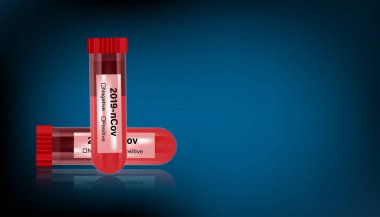 Pandemik virüs ve antiviral ilaç koronavirüs konsepti. Kan tüpü testi arka planda izole edildi. Vektör illüstrasyon tasarımı.