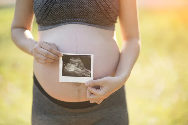 Gravid kvinna med ultraljud bild av sitt barn — Stockfoto