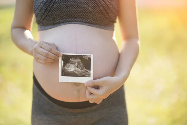 Gravid kvinna med ultraljud bild av sitt barn — Stockfoto