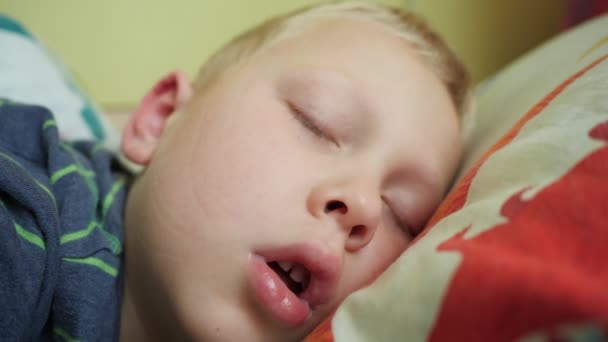 Portret. De jongen slaapt zijn mond wijd open. De neus van een kind dat niet ademt als gevolg van een verkoudheid. — Stockvideo