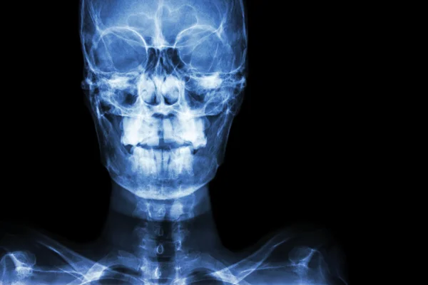 Normal human's skull and blank area at right side — Stock Photo, Image