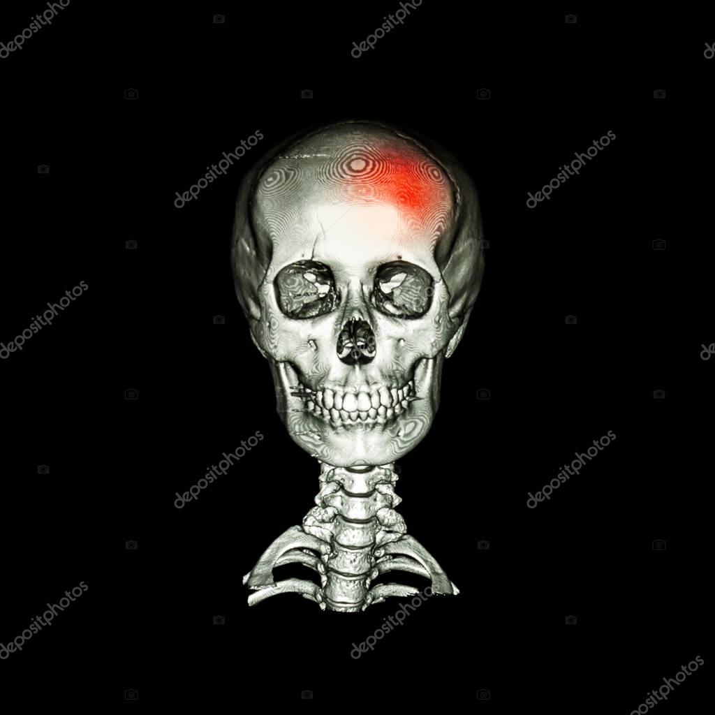 stockdevil_666