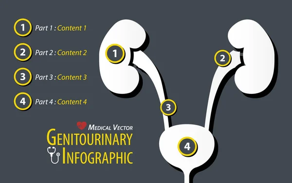 Genitourinary Infographic . Flat design . — Stock Illustration Genitourinary Infographic . Flat design . Royalty Free Stock Vectors