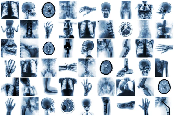 Raio-X múltiplas partes do ser humano e muitas condições médicas e doenças — Fotografia de Stock