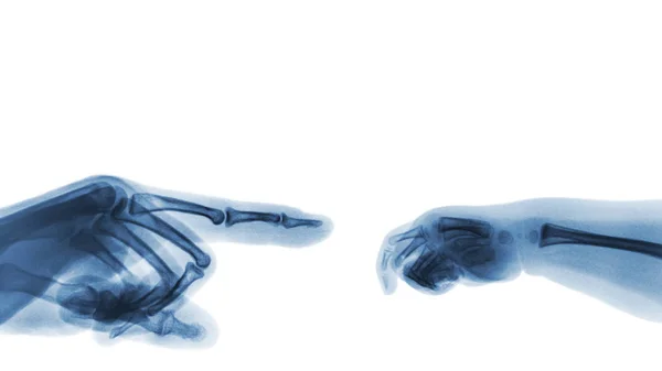 Röntgen Erwachsenen die Hand Zeigefinger auf der linken Seite und Baby die Hand auf der rechten Seite. leere Fläche an der Oberseite — Stockfoto