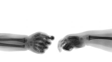 Bebeğin x-ray ve üst tarafında boş alanı eller. (El sallamak). İzole