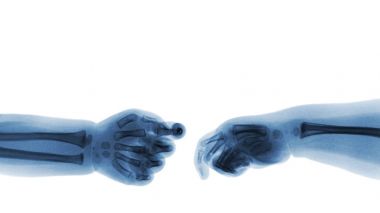 Bebeğin x-ray ve üst tarafında boş alanı eller. (El sallamak). İzole