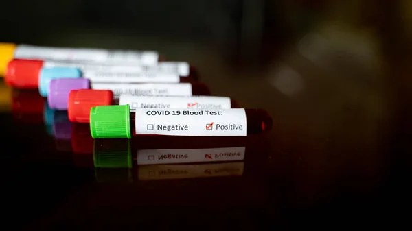 Wirus Korony Covid Koncepcja Nowego Wirusa Korony — Zdjęcie stockowe