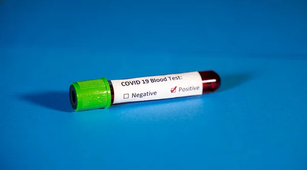 Corona virus Covid-19 novel corona virus concept