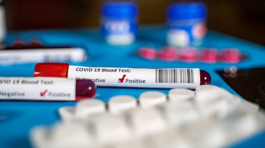 Corona virüsü Covid-19 Corona virüsü konsepti