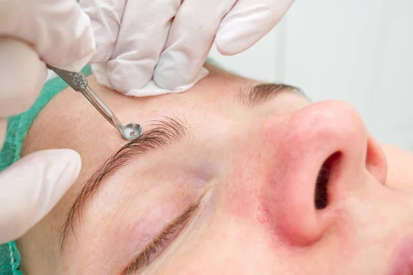 Esteticista remove - aperta a acne do rosto de uma jovem menina bonita. O conceito de cosmetologia. O cosmetologist executa o procedimento para limpar o rosto com a pele do problema . — Fotografia de Stock