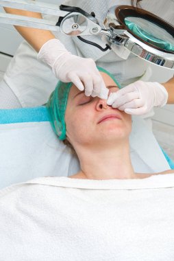 Güzellik uzmanı genç ve güzel bir kızın yüzündeki sivilceleri alıyor. Kozmetik bilimi kavramı. Kozmetik uzmanı, yüzü sorunlu ciltlerle temizlemek için prosedürü uygular..