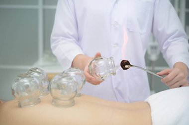 Doktor hastaları yerine koymak için bardak hazırlıyor.