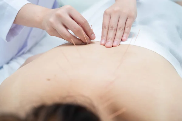 Close-up, paciente recebendo acupuntura de acupunturista na clínica — Fotografia de Stock