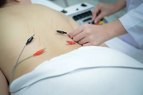 Ear electro-acupuncture - Stock Image - M745/0212 - Science Photo Library