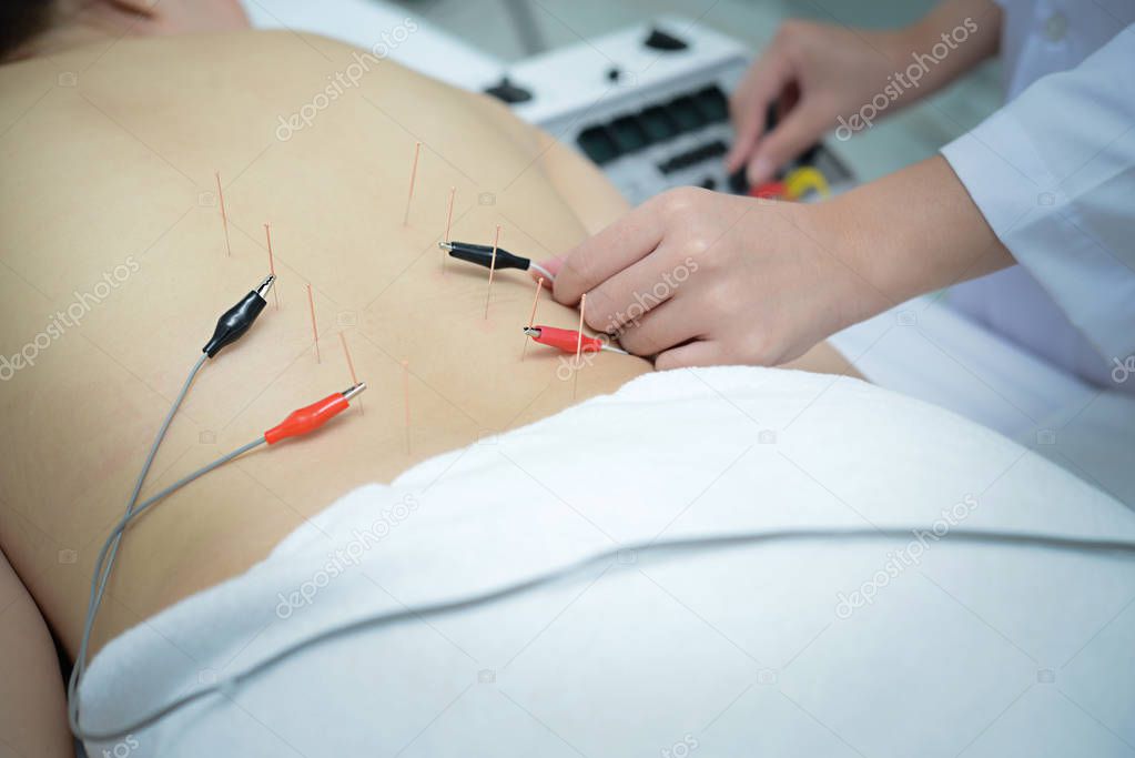 Electro Acupuncture.Traditional Chinese acupuncture and Electroa