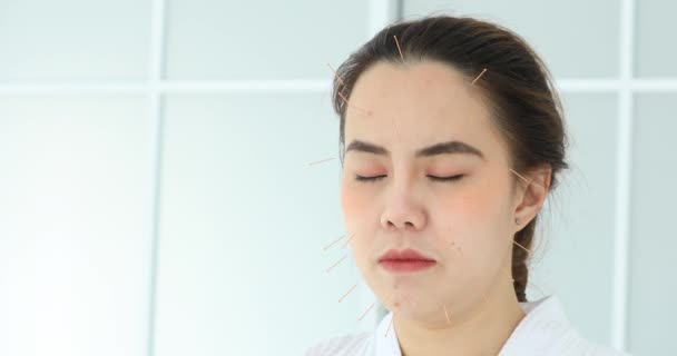 Closeup Patiënt Krijgt Acupunctuur Van Acupuncturist Kliniek Voor Chinese Geneeskunde — Stockvideo