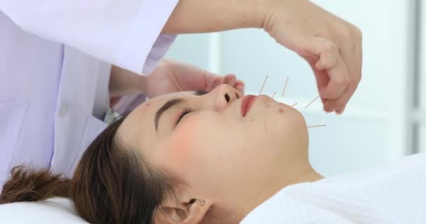 Yakın Çekim Akupunkturcudan Akupunktur Alan Hasta Çin Tıbbı Tedavisi Için — Stok video