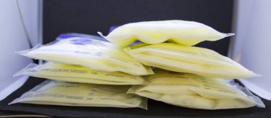 Bebek beslenme için donmuş anne sütü pompalı