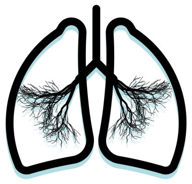 Human Lung filled with Pollution - Illustration as EPS 10 File clipart
