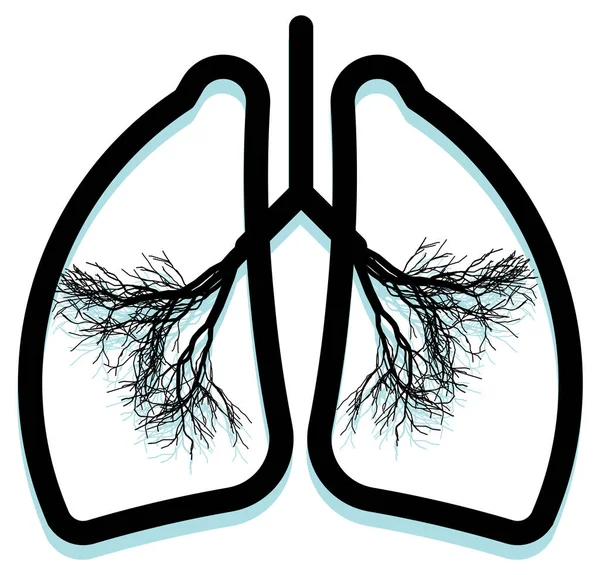 Menschliche Lunge Voller Umweltverschmutzung Abbildung Als Eps Datei — Stockvektor