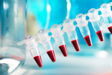 portre üzerinde plastik tüpler pcr ile dna analizi için