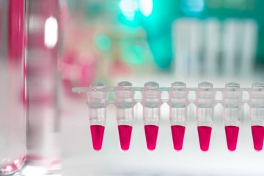 portre üzerinde plastik tüpler pcr ile dna analizi için