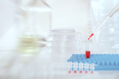 Sıvı örneği otomatik pipet, boşluk yükleme