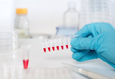 örneklerini dna PCR eldivenli elini kullanarak yükseltmek için