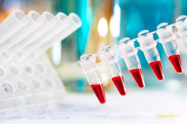pcr reaksiyon dna analiz etmek için kırmızı örnekleri ile plastik tüpler